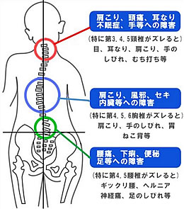 歪んだ骨盤と背骨はいろいろな病気の原因になっています